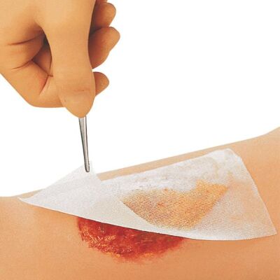 CUTICERIN® Salbenkompresse Gazeverband