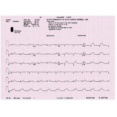 ACI-TIPI Software für MAC 5500 HD