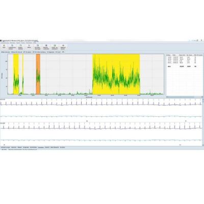 Afib Standard für CardioDay Easy für Langzeit EKG