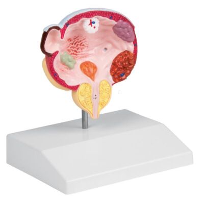 Erkrankungen von Blase und Prostata