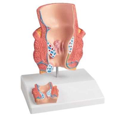Hämorrhoidenmodell 2-fache Größe