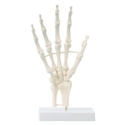 Handskelett unbeweglich