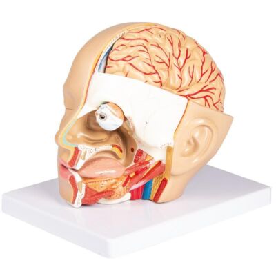 Kopf zerlegbar 4 Teile Linke Kopfseite sagittal und horizontal eröffnet
