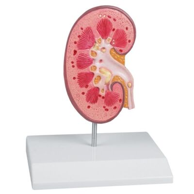 Nierensteinmodell auf Stativ