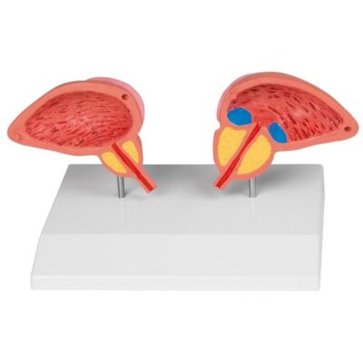 Prostata Modell 2-teilig