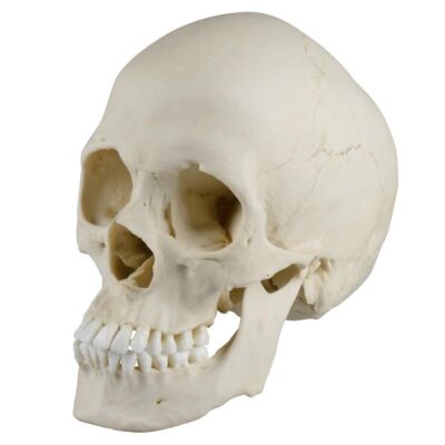 Skaphozephaler Schädel