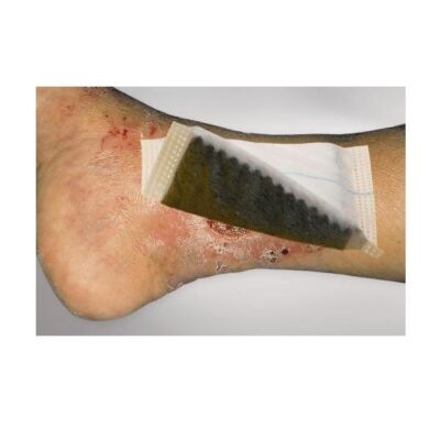 Vliwaktiv Ag Aktivkohle-Wundverband
